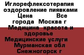 Иглорефлексотерапия, оздоровление пиявками › Цена ­ 3 000 - Все города, Москва г. Медицина, красота и здоровье » Медицинские услуги   . Мурманская обл.,Снежногорск г.